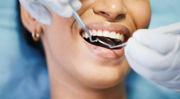 Best Broken or Cracked Tooth Emergency Dentist in Lido Beach, NY